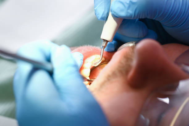 Best After-Hours Dental Trauma Care in Robbins, NC