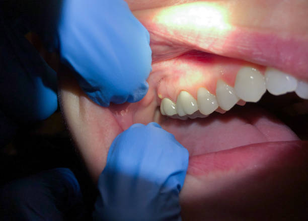 Best Pediatric Emergency Dentist in Robbins, NC