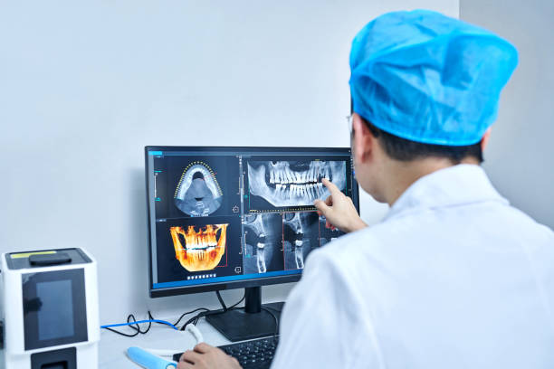 Best Emergency Wisdom Teeth Removal in Robbins, NC